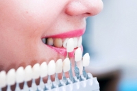 Зубные импланты. Особенности и правила выбора