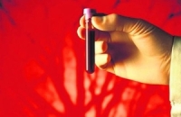 Ученые из Америки разработали новый анализ крови на аллергию после установки имплантатов