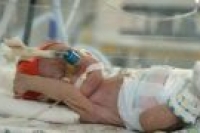 Сейчас врачам удается спасать 80% новорожденных, появившихся на свет с экстремально низкой массой тела