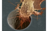 Британские ученые нашли способ остановить рост раковых клеток