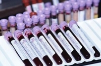 Стволовые клетки могут стать надеждой для больных гемофилией