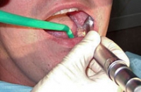 Лечение зубов — серьезное вмешательство, не терпящее халатности