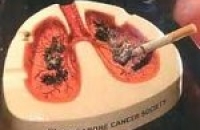 У бывших курильщиков рак хуже поддается лечению