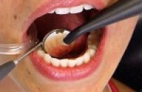 Ревматизм и лечение зубов