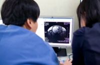 Врачи научились оценивать боль с помощью сканирования мозга