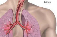3-я фаза клинических испытаний подтвердила эффективность нового лекарства от астмы