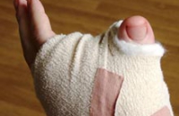 Неожиданный ход врачей изменил жизнь мужчины, лишившегося пальца руки