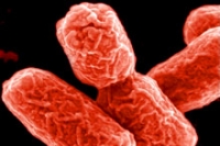 Австралия на пороге эпидемии, вызванной E.coli Австралия на пороге эпидемии, вызванной E.coli