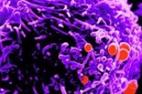 В США остался только один антибиотик, к которому чувствителен гонококк В США остался только один антибиотик, к которому чувствителен гонококк