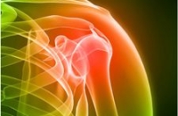 Боль в суставах при ревматоидном артрите