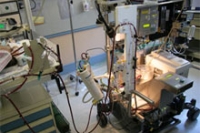 Система ECMO поддерживает жизнь в органах уже издавна умерших людей Система ECMO поддерживает жизнь в органах уже издавна умерших людей