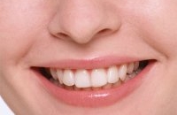 8 Доступных способов сделать зубы белее