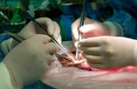Самая быстрая пересадка печени проведена британскими хирургами