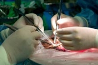 Самая быстрая пересадка печени проведена британскими хирургами Самая быстрая пересадка печени проведена британскими хирургами
