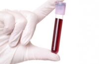 В первый раз образец пуповинной крови из России будет использован для спасения жизни иностранного пациента