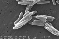 Экспертный совет FDA в первый раз за 40 лет одобрил новое лекарство от туберкулеза Экспертный совет FDA в первый раз за 40 лет одобрил новое лекарство от туберкулеза