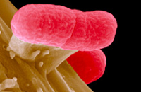Нарушения в работе всего одной молекулы могут сделать человека беззащитным перед E.coli