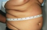 Наличие ожирения в подростковом возрасте позже может привести к развитию рака