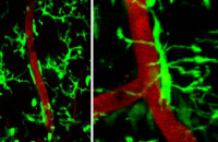 Ученые увидели начало поражения нервов при рассеянном склерозе