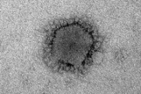 Медики выяснили продолжительность инкубационного периода «Ближневосточного» вируса