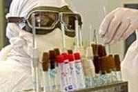 Врожденный иммунитет к ВИЧ и сибирской язве бывает! Врожденный иммунитет к ВИЧ и сибирской язве бывает!