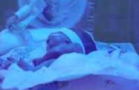 Медики спасли новорожденного с помощью охлаждения