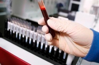 В США начали определять отцовство по анализу крови на 12 неделе беременности