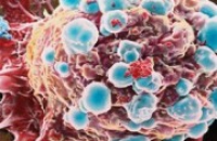 Инкурон приступил к клиническим испытаниям продукта по борьбе с резистентными видами рака
