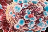 Инкурон приступил к клиническим испытаниям продукта по борьбе с резистентными видами рака Инкурон приступил к клиническим испытаниям продукта по борьбе с резистентными видами рака