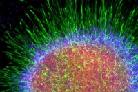 Стволовые клетки для лечения лейкозов можно производить в лаборатории
