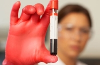 Госдуме предложили отменить врачебную тайну при тестировании на наркотики