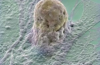 Ученые получили клетки легких из стволовых клеток пуповинной крови