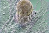 Ученые получили клетки легких из стволовых клеток пуповинной крови