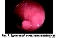Овощи и фрукты снижают риск толстокишечных полипов Овощи и фрукты снижают риск толстокишечных полипов