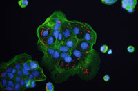Иммунная клетка убивает себя, чтобы помочь уничтожить бактерию