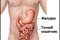 Полиомиелит — болезнь, описанная в книгах по истории