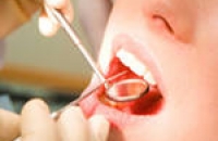 Пирсинг на языке вреден для зубного здоровья