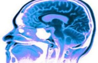 Плохая связь между отделами мозга вызывает анорексию