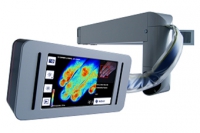 Разработана лазерная доплерография для диагностики ожогов в реальном времени
