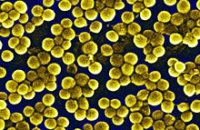 Новый штамм метициллин-резистентного золотистого стафилококка обнаружен в Великобритании