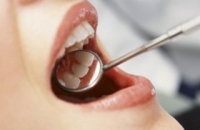 Кариес — безотлагательный визит к стоматологу
