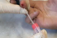 Открыт антивирусный фермент, который способствует развитию некоторых форм рака Открыт антивирусный фермент, который способствует развитию некоторых форм рака