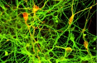 Создается уникальный банк клеток головного мозга пациентов с болезнью Паркинсона