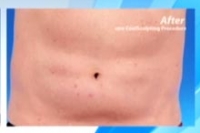 Имена и фотографии клиенток пластического хирурга стали достоянием общественности Имена и фотографии клиенток пластического хирурга стали достоянием общественности