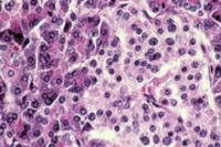 Сенсация: ученым впервые удалось полностью вылечить диабет