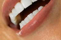 Здоровые зубы в домашних условиях