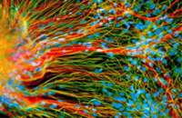 Регенерация перерезанных нервов при помощи стволовых клеток на хитозановых волокнах