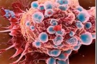 Ученые убивают рак голодом Ученые убивают рак голодом