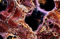 Восстановление функций печени на клеточном уровне: первая успешная операция Восстановление функций печени на клеточном уровне: первая успешная операция