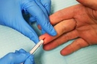 В Латвии отмечен резкий скачок венерических заболеваний В Латвии отмечен резкий скачок венерических заболеваний